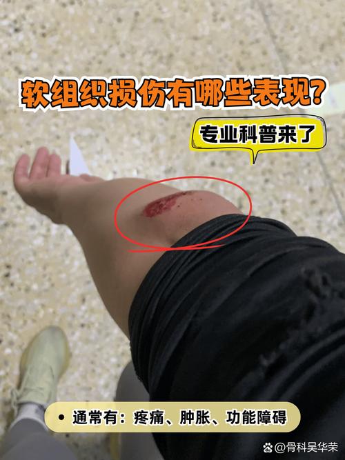 同一位置受伤，不同公司责任如何划分？-图2