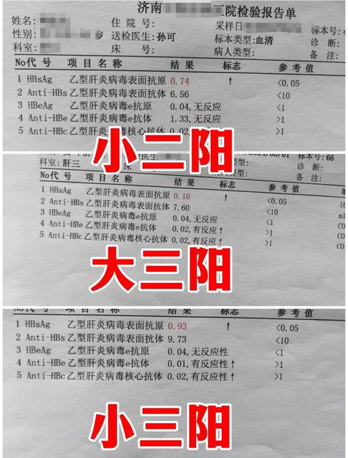 公司能否因员工小三阳解雇或拒录？-图3